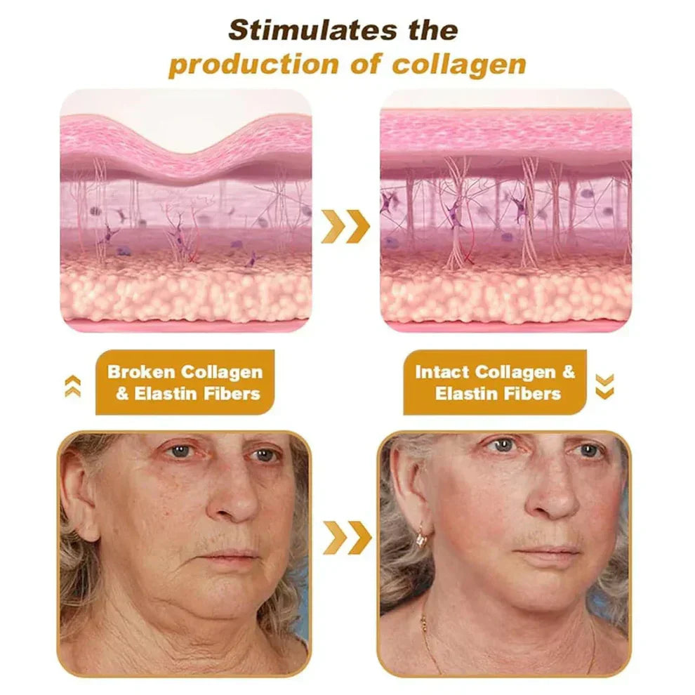 Botox Bee Venom Wrinkle Removal Cream